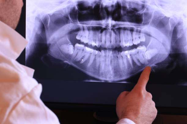 Best Emergency TMJ Treatment in Bayboro, NC
